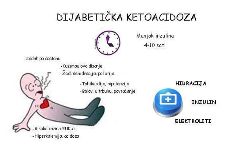 Dijabetička ketoacidoza