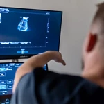 Ultrazvuk abdomena - priprema, postupak i cijena