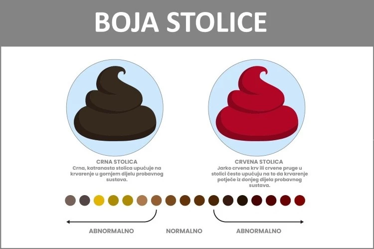 Krv u stolici i crna stolica: kada se javiti liječniku